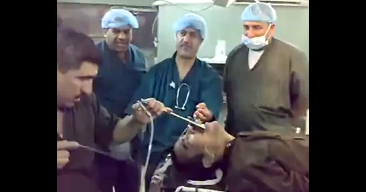 Chirurdzy wyciągają zardzewiały klucz z gardła mężczyzny w Indiach… a potem się z tego śmieją